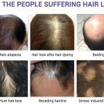 growth oil for hair (1)