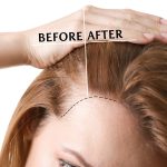 hair growth oil private label (4)