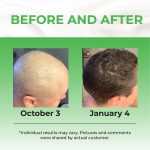 hair growth serum (2)