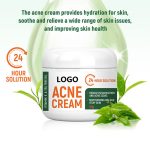 Acne Cream Treatment (3)