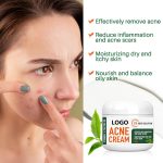 Acne Cream Treatment (5)