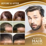 Biotin Hair Regrowth Oil (3)