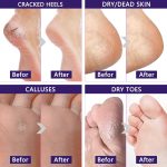 Foot peel effect.1 (4)