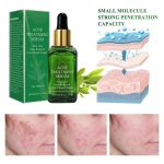 Anti-Acne Serum (5)