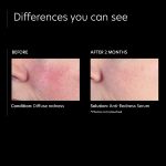 Anti-Redness Serum (2)