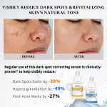 Dark Spot Remover Supplier, Dark Spot Corrector Manufacturer (1)