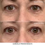 organic eye cream (4)