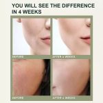 Anti-Aging Cream (4)