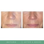 Anti-Aging Face Neck Night Cream (4)