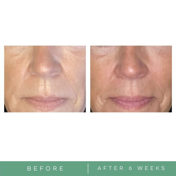 Anti-Aging Night Cream contract manufacturing, custom formulas and private label