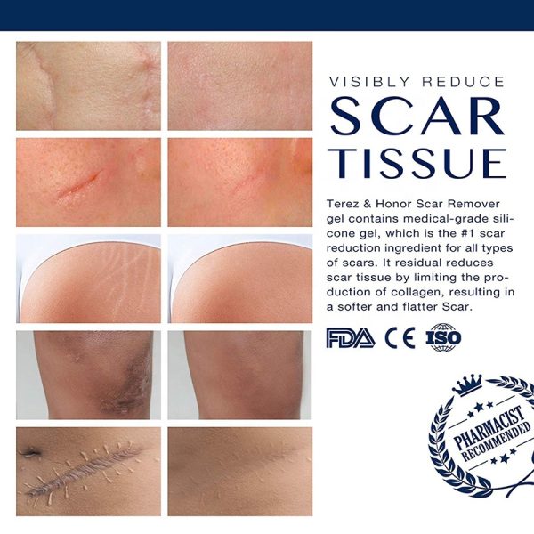 Scar Gel contract manufacturing, custom formulas and private label