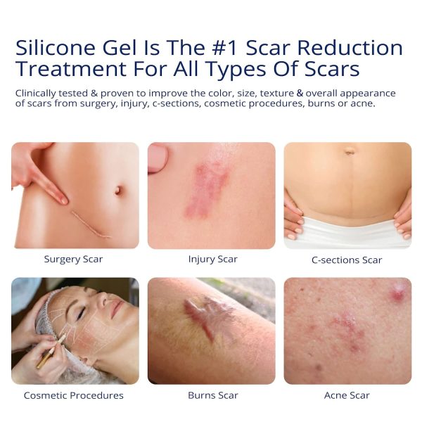 Scar Gel contract manufacturing, custom formulas and private label