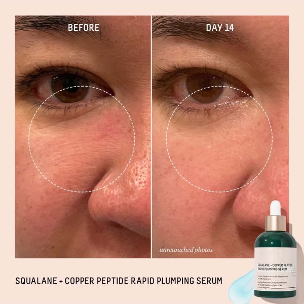 Anti Aging Peptide Serum contract manufacturing, custom formulas and private label