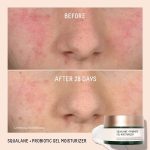 Squalane + Probiotic Gel Moisturizer (6)