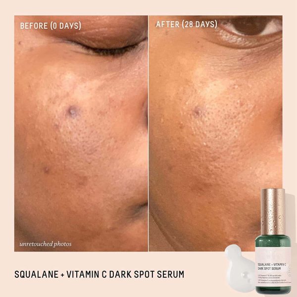 Dark Spot Facial Serum contract manufacturing, custom formulas and private label